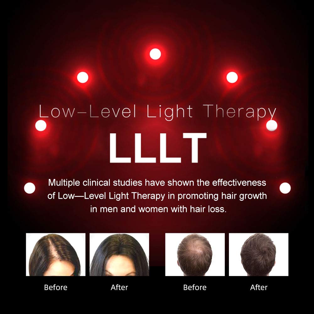 Hhair growth system, hair loss laser cap treatment device.