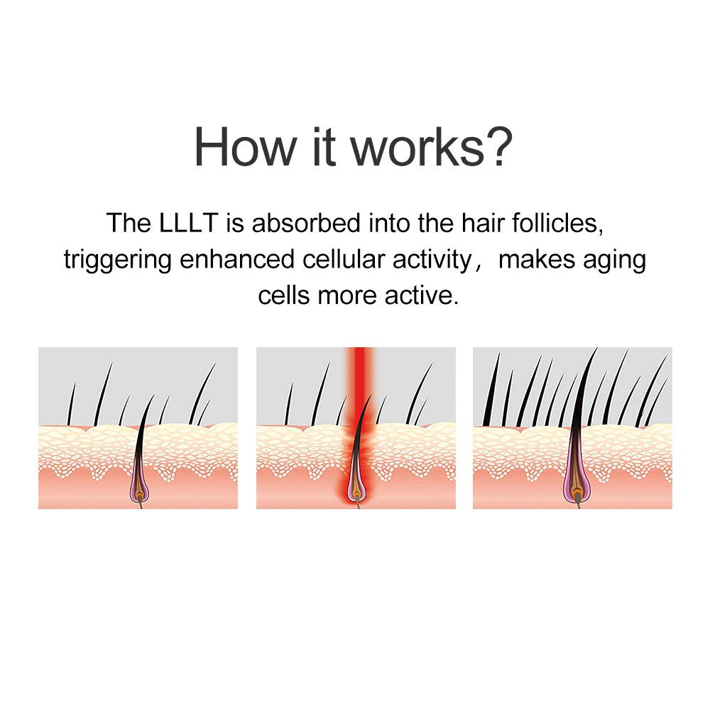 Hhair growth system, hair loss laser cap treatment device.